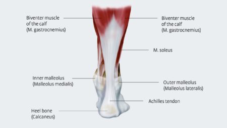 Achilles Tendon 4