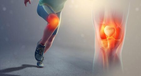 Iliotibial-Band-2