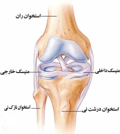 Knee Meniscus Injury 1