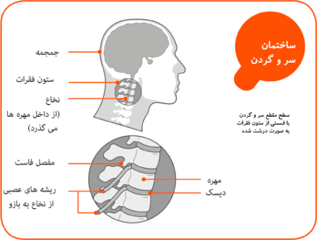 Neck-Pain-2