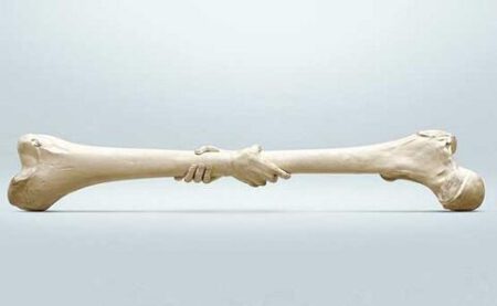Osteoporosis 1