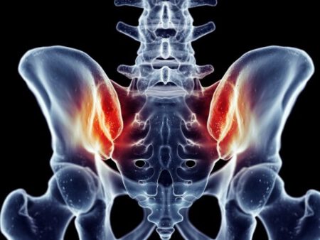 Sacroiliac Joint 3
