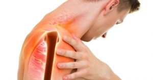 پارگی روتاتور کاف در ناحیه شانه چیست