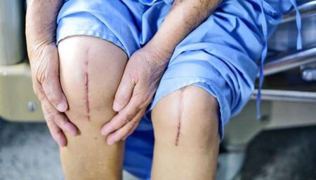 جلوگیری از عفونت پس از عمل جراحی