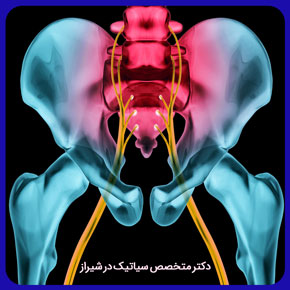 دکتر متخصص سیاتیک در شیراز و لیست پزشکان متخصص سیاتیک در شیراز و بررسی علائم و معرفی بهترین درمان سیاتیک با قیمت مناسب 📞رزرو فوری نوبت حضوری دکتر متخصص رگ سیاتیک در شیراز متخصص سیاتیک در شیراز دکتر متخصص سیاتیک در شیراز فوق تخصص عصب سیاتیک در شیراز بهترین متخصص سیاتیک در شیراز