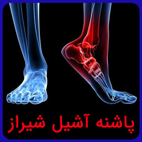 پاشنه آشیل شیراز و معرفی بهترین دکتر پاشنه آشیل در شیراز به همراه مراکز فیزیوتراپی پاشنه آشیل با قیمت مناسب رزرو فوری نوبت آنلاین پاشنه آشیل شیراز پاشنه آشیل یعنی چه پاشنه اشیل معنی پاشنه آشیل پاشنه اشیل یعنی چی آشیل پاشنه آشیل به انگلیسی