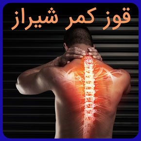 قوز کمر شیراز و معرفی بهترین دکتر قوز کمر در شیراز به همراه مراکز فیزیوتراپی درمان قوز کمر با ورزش و قیمت مناسب رزرو فوری نوبت آنلاین قوز کمر شیراز درمان قوز کمر در شیراز دکتر قوز کمر شیراز بهترین دکتر قوز کمر شیراز متخصص قوز کمر در شیراز قوز کمر چیست حرکات اصلاحی قوز کمر درمان قوز کمر عمل قوز کمر اصلاح قوز کمر تمرین قوز کمر