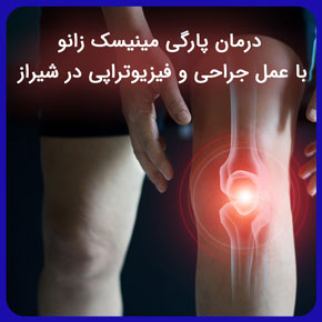 درمان پارگی مینیسک زانو با عمل جراحی و فیزیوتراپی در شیراز و لیست پزشکان متخصص زانو و بررسی علائم پارگی منیسک زانو با قیمت مناسب رزرو نوبت درمان پارگی مینیسک زانو با فیزیوتراپی در شیراز مینیسک زانو به انگلیسی درمان پارگی رباط زانو درمان پارگی مینیسک زانو پارگی مینیسک زانو چگونه درمان میشود پارگی مینیسک زانو چیست پارگی مینیسک زانو مینیسک زانو درد مینیسک زانو مینیسک درمان زانو درد با ورزش