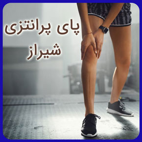 پای پرانتزی شیراز و معرفی بهترین دکتر پای پرانتزی در شیراز و درمان پای پرانتزی بدون جراحی در شیراز با قیمت مناسب رزرو فوری نوبت آنلاین پای پرانتزی شیراز درمان پای پرانتزی شیراز درمان پای پرانتزی بدون جراحی شیراز درمان پای پرانتزی در شیراز بهترین جراح پای پرانتزی در شیراز پا پرانتزی پای پرانتزی به انگلیسی