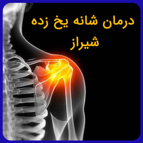 درمان شانه یخ زده شیراز و بررسی علائم شانه یخ زده به همراه معرفی بهترین دکتر درمان یخ زدگی شانه در شیراز با قیمت مناسب رزرو نوبت آنلاین درمان شانه یخ زده شیراز علائم شانه یخ زده شانه یخ زده یخ زدگی شانه شانه یخ زده چیست درمان افتادگی شانه درمان رشک سر