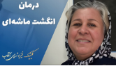 درمان انگشت ماشه ای