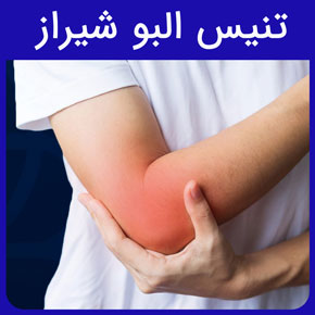 تنیس البو شیراز و معرفی بهترین دکتر تنیس البو در شیراز و درمان تنیس البو با فیزیوتراپی بدون جراحی در شیراز با قیمت مناسب رزرو فوری نوبت آنلاین تنیس البو شیراز تنیس البو درمان