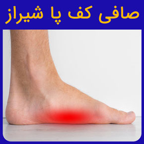 صافی کف پا شیراز و معرفی بهترین دکتر صافی کف پا در شیراز به همراه مراکز فیزیوتراپی صافی کف پای خفیف و شدید با قیمت مناسب رزرو فوری نوبت آنلاین صافی کف پا شیراز فوق تخصص صافی کف پا شیراز دکتر متخصص صافی کف پا در شیراز صافی کف پا