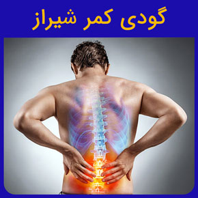 گودی کمر شیراز و معرفی بهترین دکتر گودی کمر در شیراز به همراه مراکز فیزیوتراپی گودی کمر خفیف و شدید با قیمت مناسب رزرو فوری نوبت آنلاین گودی کمر شیراز دکتر گودی کمر شیراز درمان گودی کمر شیراز متخصص گودی کمر شیراز گودی کمر چیست گودی کمر گودی کمر به انگلیسی گودي كمر از بین بردن گودی کمر اصلاح گودی کمر رفع گودی کمر قوس کمر