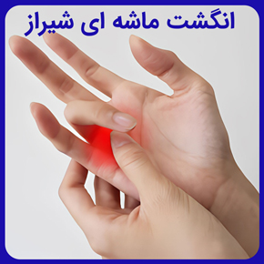 انگشت ماشه ای شیراز و انگشت ماشه ای دست و علائم انگشت ماشه ای و انگشت ماشه ای چیست و درمان انگشت ماشه ای در شیراز