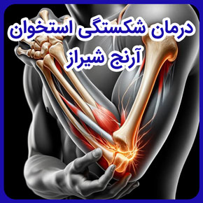 درمان شکستگی استخوان آرنج شیراز و درمان شکستگی استخوان ارنج و شکستگی استخوان آرنج دست و علائم شکستگی استخوان ارنج و شکستگی سر استخوان آرنج