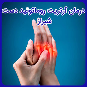 درمان آرتریت روماتوئید دست شیراز و درمان آرتریت روماتوئید انگشتان دست و علائم آرتریت روماتوئید دست و درمان بیماری آرتریت روماتوئید در دست
