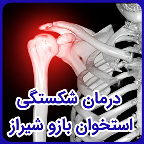 درمان شکستگی استخوان بازو شیراز و درمان شکستگی سر استخوان بازو و درمان شکستگی ساق استخوان بازو و انواع شکستگی استخوان بازو و تشخیص شکستگی بازو