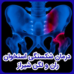 درمان شکستگی استخوان ران و لگن شیراز و درمان شکستگی استخوان ران و لگن و شکستگی استخوان ران متصل به لگن و درمان شکستگی سر استخوان ران و لگن