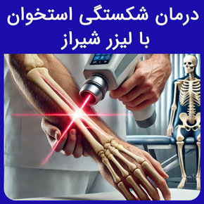 درمان شکستگی استخوان با لیزر شیراز و فیزیوتراپی با لیزر در درمان کمر درد و هزینه هر جلسه لیزر پرتوان در فیزیوتراپی آفتاب شیراز نوبت آنلاین هزینه هر جلسه لیزر پرتوان عوارض لیزر پرتوان فیزیوتراپی لیزر درمانی لیزر درمانی دیسک کمر لیزر کم توان درمان کمر درد فیزیوتراپی با لیزر لیزر پرتوان فیزیوتراپی چیست