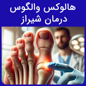 هالوكس والگوس درمان شیراز و درمان قطعی هالوکس والگوس در فیزیوتراپی آفتاب و انواع انحراف شست پا و مراقبت های بعد از عمل و نحوه راه رفتن درست راه رفتن بعد از عمل هالوکس والگوس درمان قطعی هالوکس والگوس مراقبت بعد از عمل هالوکس والگوس درمان هالوکس والگوس انحراف شست پا هالوکس والگوس چیست انواع هالوکس والگوس دکتر ارتوپد شیراز فوق تخصص مراقبت های بعد عمل هالوکس والگوس