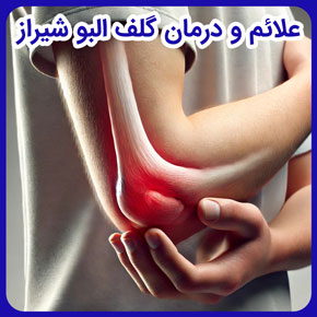 علائم و درمان گلف البو شیراز و درمان قطعی گلف البو شیراز و روش درمان گلف البو و فیزیوتراپی گلف البو شیراز و علت گلف البو و عارضه گلف البو