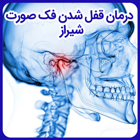 درمان قفل شدن فک صورت شیراز و علت قفل شدن فک صورت چیست و دلیل قفل شدن فک صورت و جلوگیری از قفل شدن فک صورت در شیراز و علت درد و قفل شدن فک