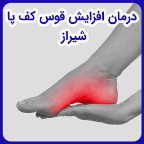 درمان افزایش قوس کف پا شیراز و درمان کف پای قوس دار در شیراز و راه درمان قوس کف پا و روش درمان قوس کف پا و درمان برای قوس زیاد کف پا در شیراز