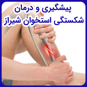 پیشگیری و درمان شکستگی استخوان شیراز و درمان شکستگی استخوان روی پا و درمان شکستگی استخوان ترقوه و پیشگیری از شکستگی مجدد استخوان پا در شیراز